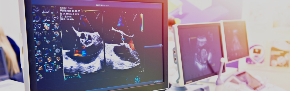 Medical Device screening